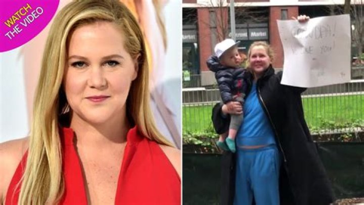 Amy Schumer scar
