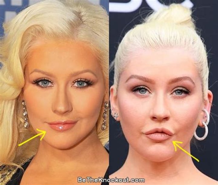 Christina Aguilera Plastic Surgery