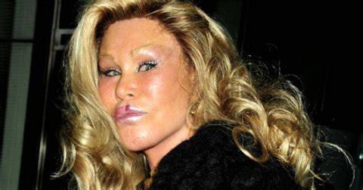 jocelyn-wildenstein