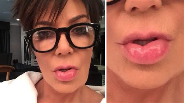 Kris Jenner Fat Lip