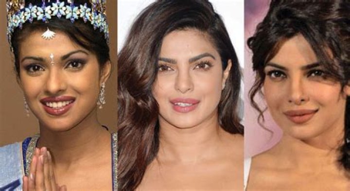 Priyanka Chopra surgery
